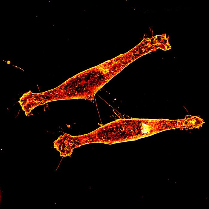 targeting-tunneling-nanotubes-reduces-spread-of-mutant-huntington’s-protein