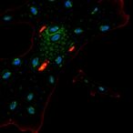 tcf4-repeat-expansion-alters-fuchs-corneal-proteome