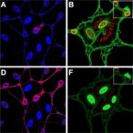 alectinib-enhances-car-t-cell-attack-in-alk-neuroblastoma