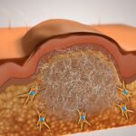 skin-regeneration-enabled-by-embryonic-healing-mechanism-in-mice