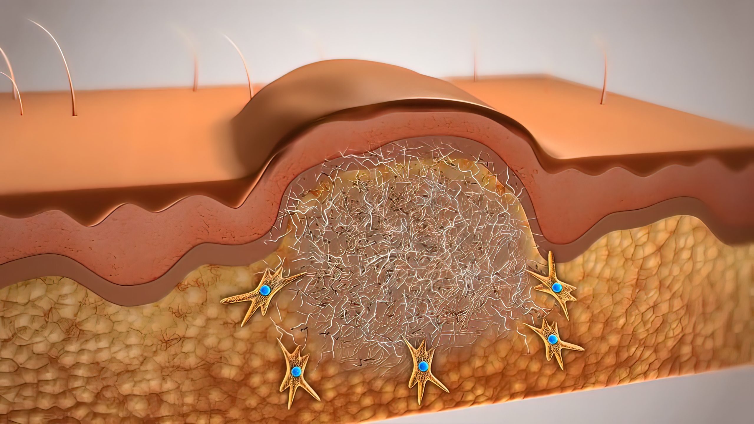 skin-regeneration-enabled-by-embryonic-healing-mechanism-in-mice