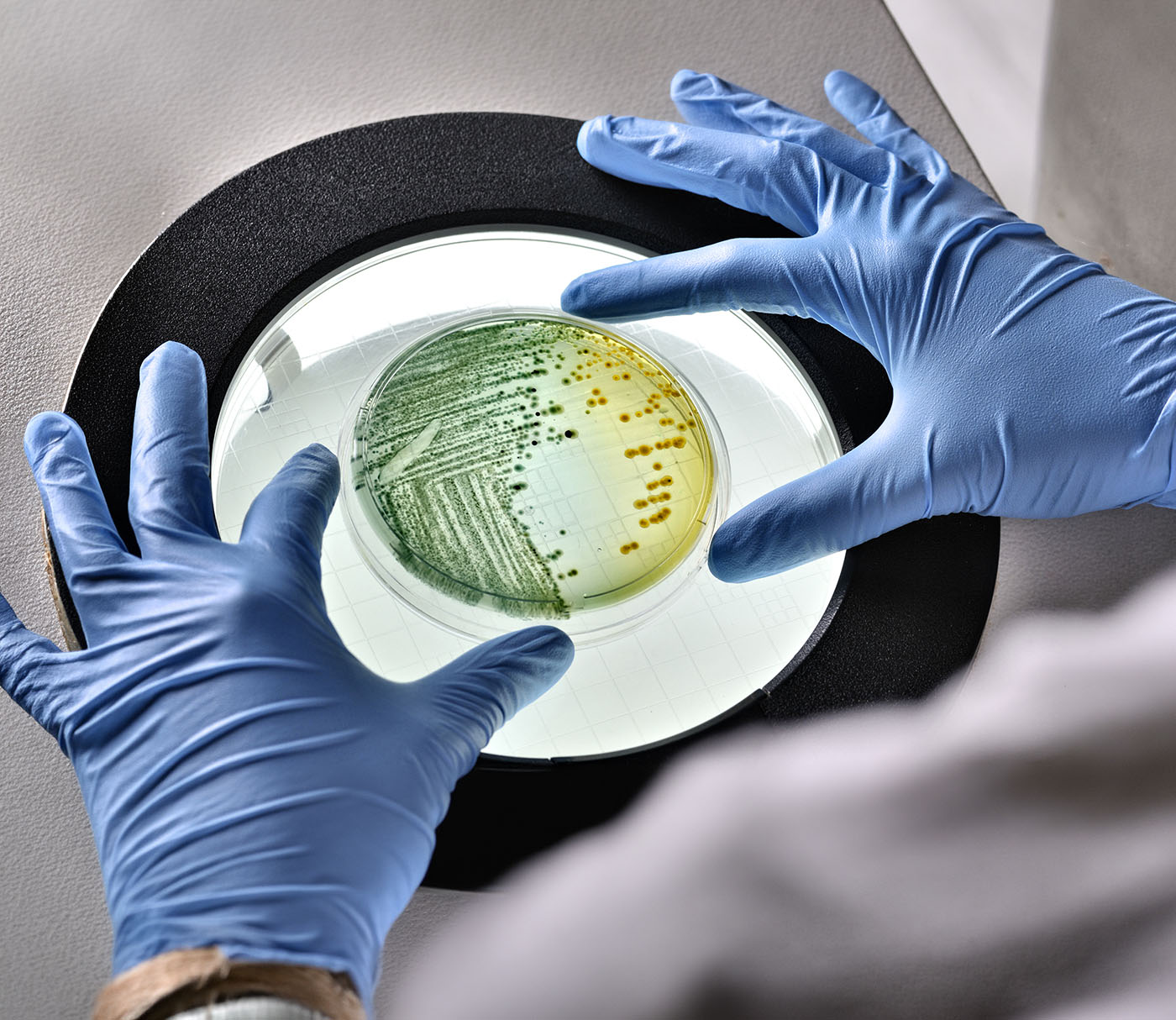 genomic-mapping-of-e.-coli-capsules-identifies-high-risk-types-for-vaccines