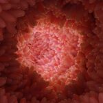 endogenex-nets-$50m-to-carry-intestinal-diabetes-procedure-to-the-fda