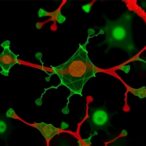 ada2-deficiency-boosts-cell-death,-metabolic-issues