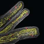 parasites-prompt-gut-brain-communication-to-trigger-appetite-loss