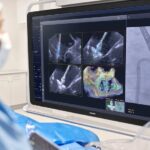 philips-ai-cath-lab-copilot-nets-fda-clearance
