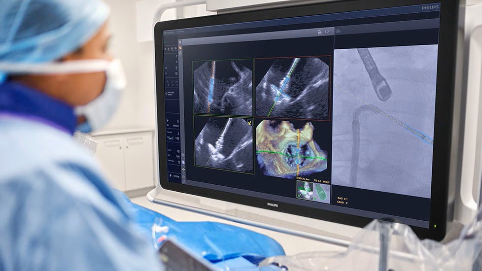 philips-ai-cath-lab-copilot-nets-fda-clearance
