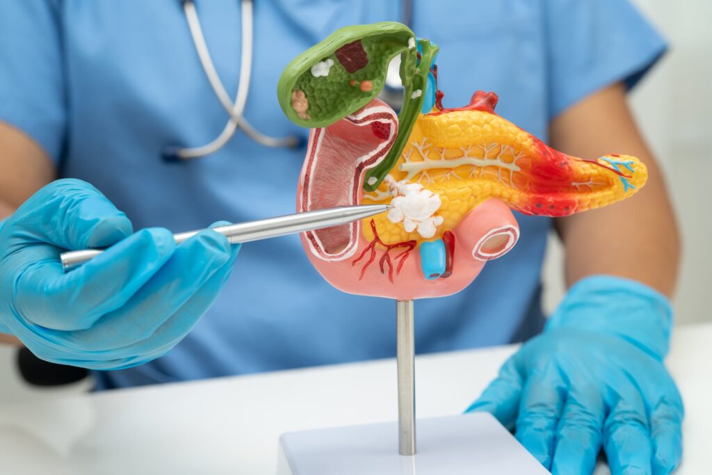 after-local-tumor-approval,-novocure-touts-positive-data-in-metastatic-pancreatic-cancer