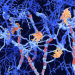 gut-immune-link-identified-in-multiple-sclerosis-related-neuroinflammation