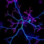 new-scalable-platform-illuminates-mechanisms-of-cancer-spread