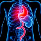 psma-therapy-extends-time-before-hormone-treatment-in-prostate-cancer