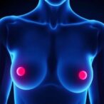menopause,-menarche-impact-breast-cancer-risk-in-brca-carriers
