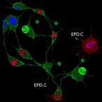 reactivating-dormant-regulatory-t-cells-eases-asthma-symptoms-in-mice