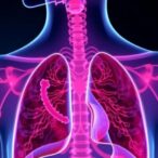 phase-1:-ceralasertib,-durvalumab-in-nsclc-and-hnscc