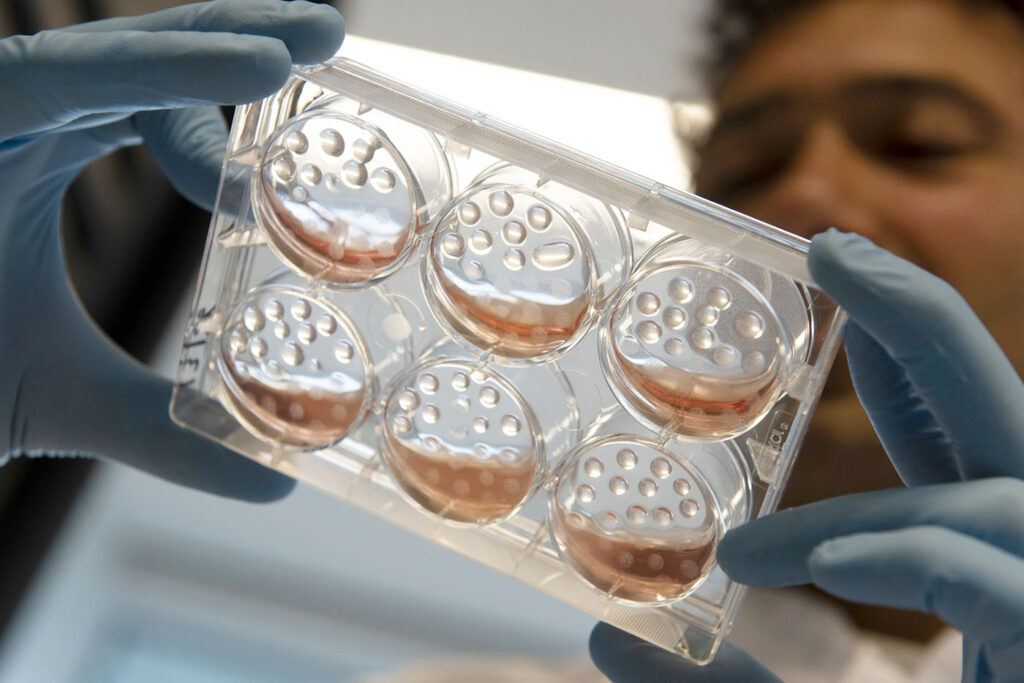 organoids-as-predictive-translational-models-for-drug-development