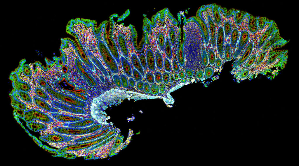 bruker’s-cellscape-xr-targets-scalable-multiplexed-immunofluorescence-imaging