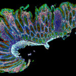 bruker’s-cellscape-xr-targets-scalable-multiplexed-immunofluorescence-imaging