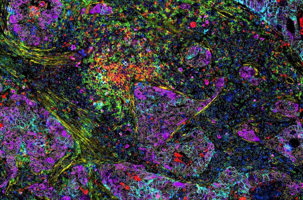 investigating-the-dynamics-of-the-tumor-microenvironment