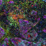 investigating-the-dynamics-of-the-tumor-microenvironment