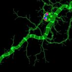 fgfr2b-links-to-biomarkers,-tumor-diversity,-survival