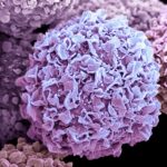 immune-response-gene-variants-tied-to-earlier-breast-cancer-in-brca1-carriers