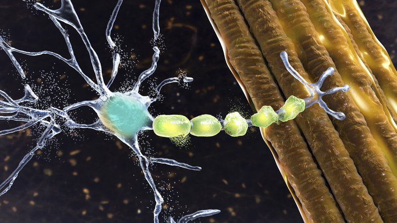biological-complexity-of-als-to-be-addressed-by-the-development-of-new-stem-cell-models