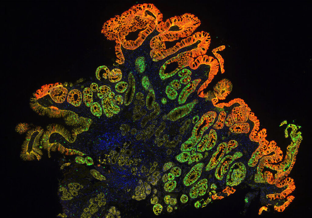 spatial-biology