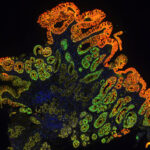 spatial-biology