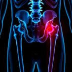 inhibiting-md2-may-prevent-bone-metastasis-in-prostate-cancer