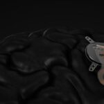 epia-neuro-launches-with-bci-device-to-help-stroke-patients-rework-brain-signals