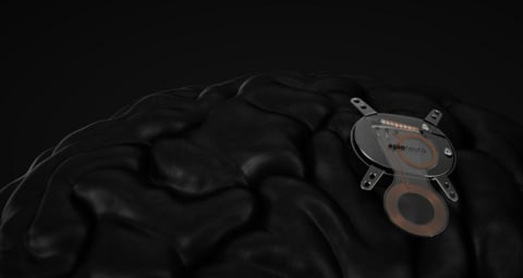 epia-neuro-launches-with-bci-device-to-help-stroke-patients-rework-brain-signals