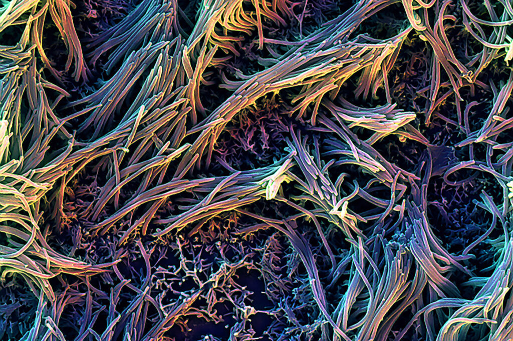 accelerating-organoid-adoption-set-to-transform-cancer-drugs