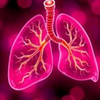 biomarker-analysis-tracks-azd2811-in-sclc-trial