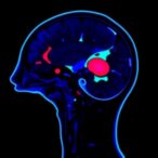 nigeria-launches-national-cancer-imaging-repository-framework