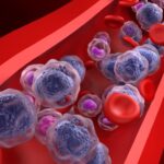epigenetic-strategy-restores-tumor-suppressor-in-acute-myeloid-leukemia-models