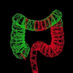 irgd-plga-nanocomplex-targets-colon-cancer-resistance