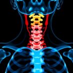 durvalumab-and-tremelimumab-treat-advanced-thyroid-cancer