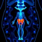 whole-body-mri-predicts-ovarian-cancer-treatment-outcomes