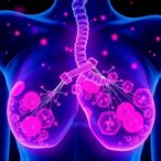 cold-plasma-activated-water-battles-breast-cancer-tumors