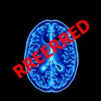 retracted-study-on-ai-transparency-in-stroke-prediction