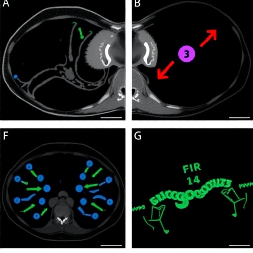 furmonertinib-plus-bevacizumab-boosts-egfr-tki-resistance-outcomes