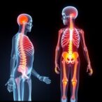 new-osteoporosis-risk-model-developed-for-chinese-elderly