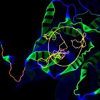 arhgap21-boosts-liver-cancer-spread-by-protecting-filamin-a