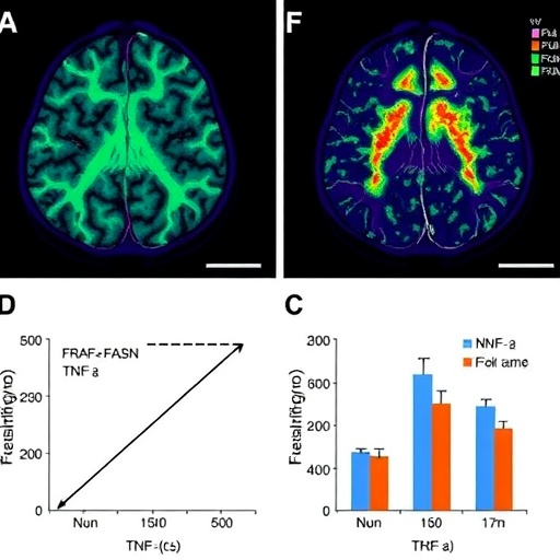 low-dose-tnf-α-fuels-glioblastoma-via-traf2-fasn