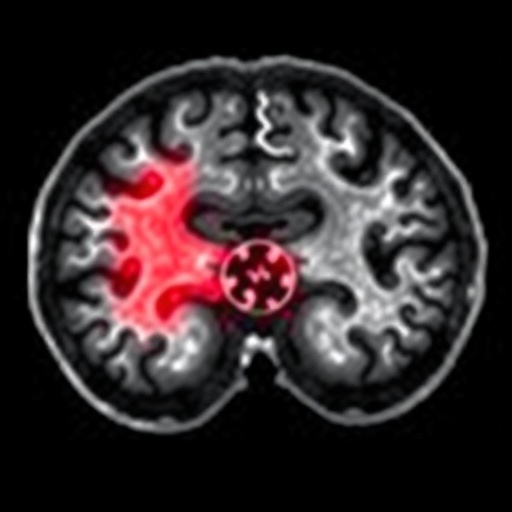 rapid-intracerebral-hemorrhage-diagnosis-via-vesicle-fractionation