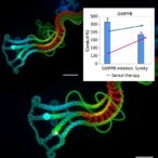 gmppb-mutation-rescued-by-gsk3β-inhibition-or-gene-therapy