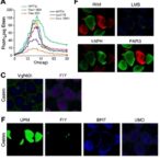 boosted-wnt10b/foxo6-drives-kidney-inflammation,-fibrosis