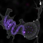 epigenetic-reader-ythdf1-halts-masld-progression
