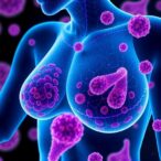 parp-inhibitors:-breast-cancer’s-breakthrough-and-resistance