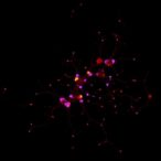 epigenetic-markers-predict-cervical-lesion-progression